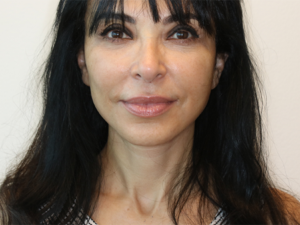 Before Image: Patient # 67875