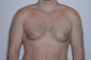 Before Image: Patient # 55502