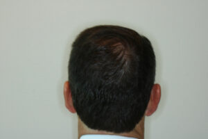 After Image: Patient # 93385