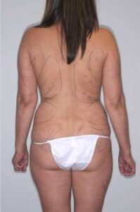 Before Image: Patient # 57810