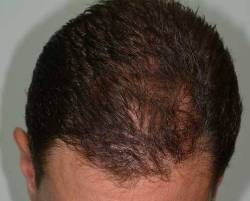 After Image: Patient # 99004 - front