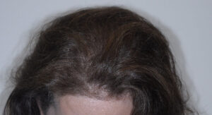 After Image: Patient # 85576