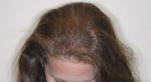 Before Image: Patient # 85576