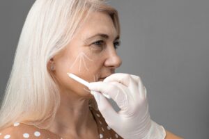 Doctor marking woman's face in facelift consultation