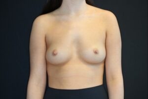 Before Image: Patient # 4184