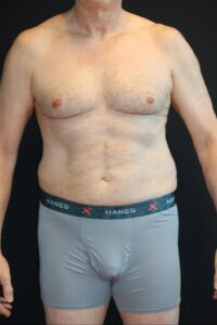 Before Image: Patient #4160