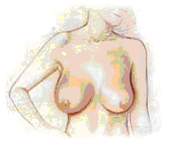 artistic drawing of female with larger breasts before a breast lift procedure