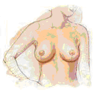 artistic drawing of a female with smaller, perkier breasts after a breast lift procedure